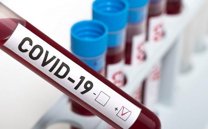 37FF8E31-5E2E-491D-9320-820F9DEC7CAF